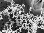 Nanopartículas de metal crecidas en microgravedad