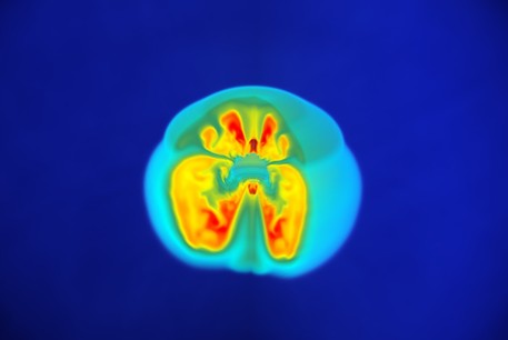 Die Computersimulation einer Supernova zeigt die Explosion eines Sterns